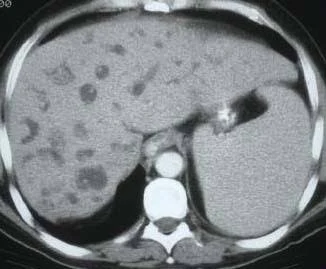 Radiology spotter